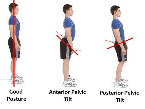 Pelvic tilt